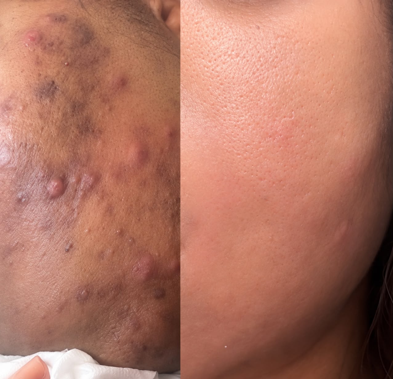 Registo antes e depois partilhado por cliente