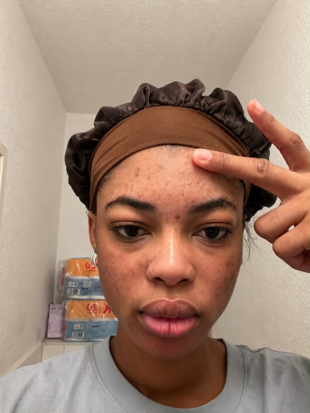 Registo partilhado por cliente do Acnes Oil Control