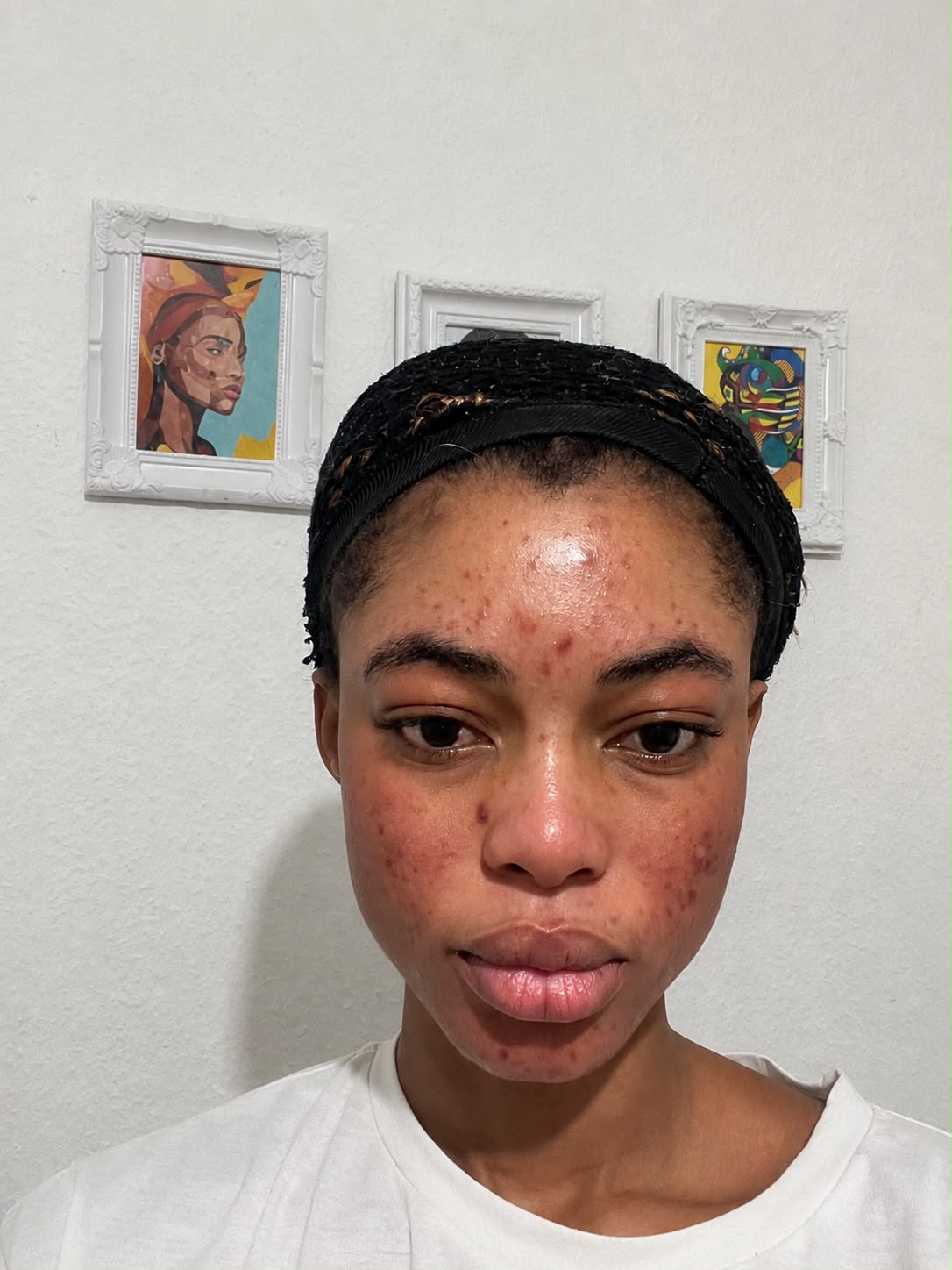 Registo partilhado por cliente do Acnes Oil Control