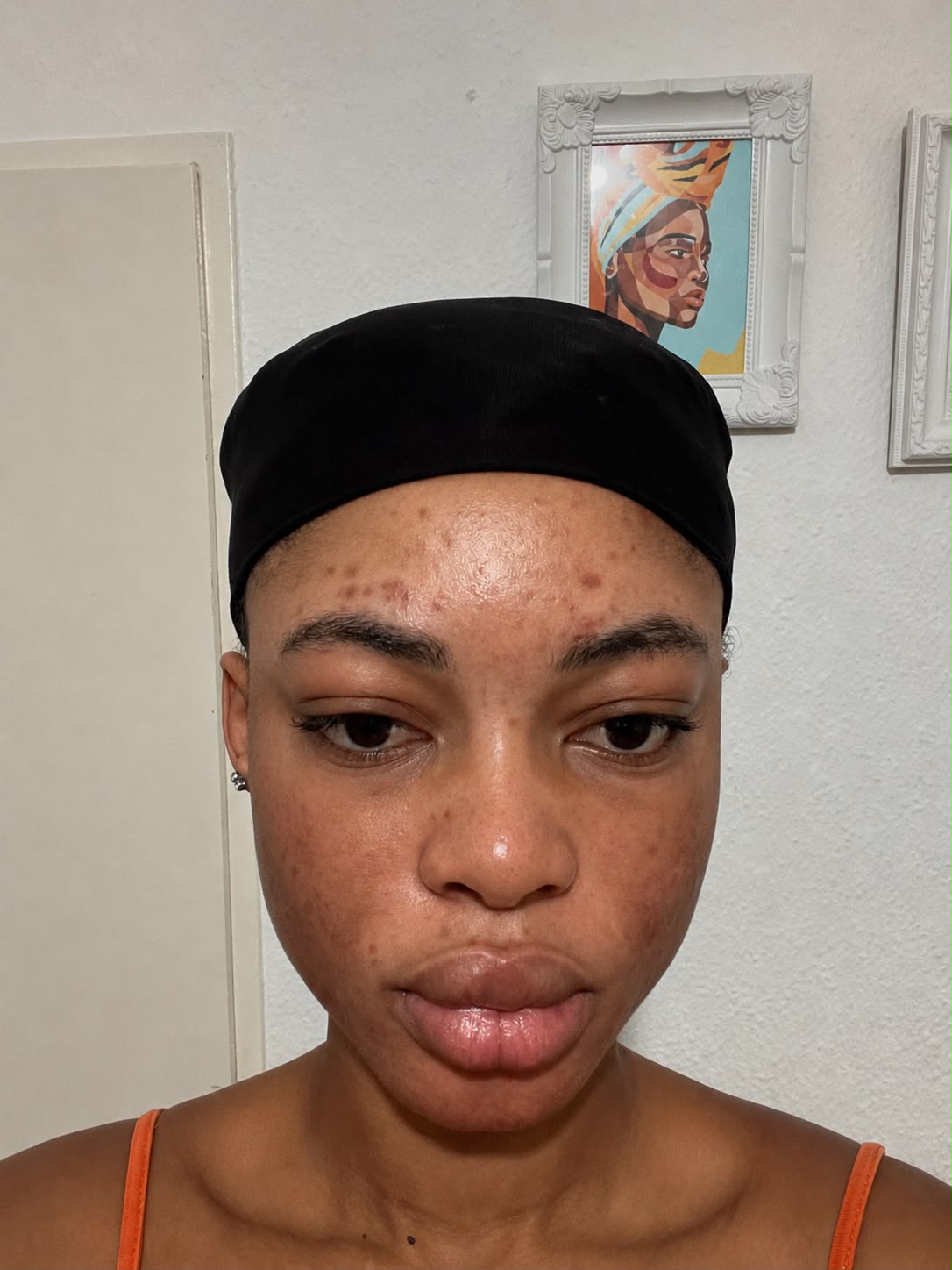 Registo partilhado por cliente do Acnes Oil Control